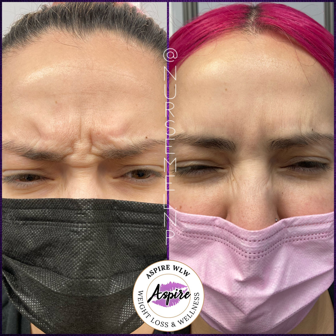 VIP Botox Membership