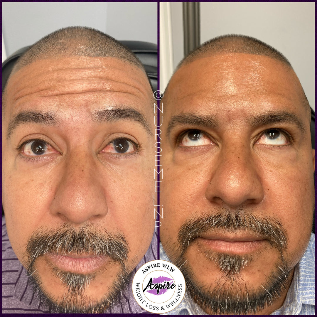 VIP Botox Membership